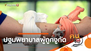 ปฐมพยาบาลผู้ถูกงูกัด : รู้สู้โรค (18 ส.ค. 63)