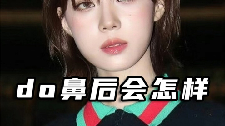 【整商】do鼻后回怎样