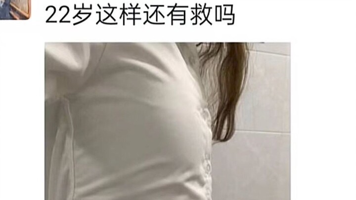 ก็แค่หลังค่อมนิดหน่อยเท่านั้นเอง