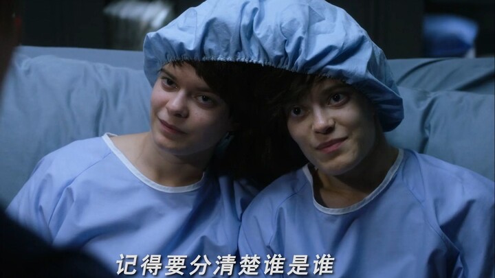 Sisters connected by their heads—yet one is secretly killing the other.