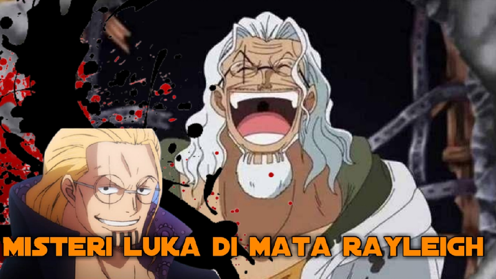 INIKAH PENYEBAB SEBENARNYA DARI LUKA DI MATA RAYLEIGH