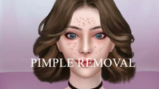 Blackhead Removal Animation ASMR video | Pimple Removal Spa Treatment