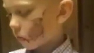 هو أصغر بطل ملاكمة، وفي سن السادسة فقط، واجه كلبًا شرسًا وحيدًا لإنقاذ أخته، وتلقى 90 غرزة على وجهه.
