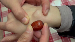 Fan takes the train to quickly eliminate a tenosynovial cyst