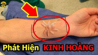 🔴Những Thứ Bí Ẩn Và Đáng Sợ Vô Tình Được Tìm Thấy Trong Cơ Thể Con Người Phần 2