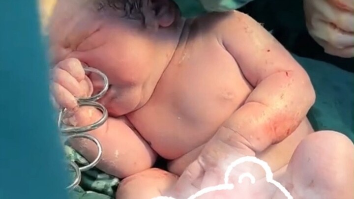 Baby casually “picked up” the doctor’s tools and was caught red-handed by the nurse—what happened ne