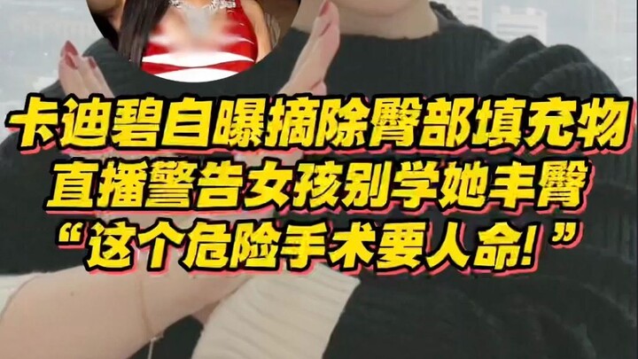 Cardi B Ungkap Telah Menghapus 95% Isian Bokong! Dalam Siaran Langsung, Ia Ingatkan Para Perempuan u