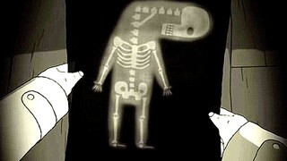 小伙颈椎天生90度弯曲，最大愿望是挺胸抬头，跟美女深情拥吻
