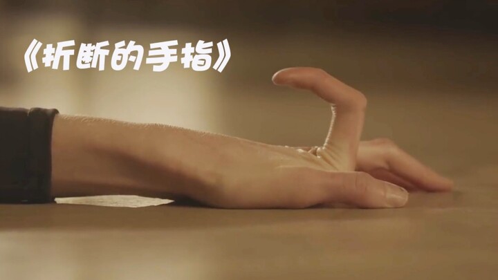 นิ้วมือของผู้หญิงคนนี้กลับถูกงอเป็นมุมเก้าสิบองศาอย่างน่าขนลุก!