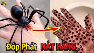 🔴Khóc Thét Với Vết Cắn Của Con Nhện Có Nọc Độc Nguy Hiểm Nhất Hành Tinh Khiến Triệu Người Kinh Sợ