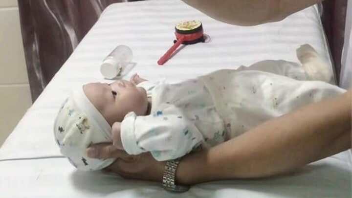 Pada pemeriksaan kesehatan bayi usia 45 hari, saat ditunjukkan pada dokter, urusan menarik tubuh, du