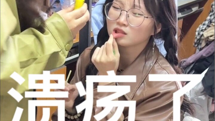 Why on Earth Do Mouth Ulcers Exist?