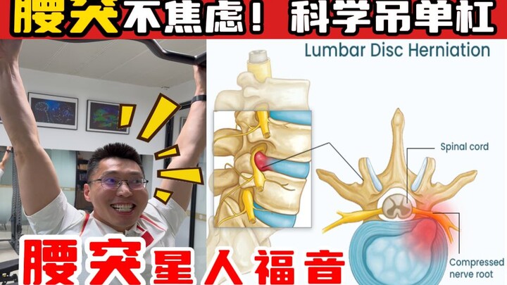 【奥运冠军的脊医博士后】腰突不焦虑！科学吊单杠！腰突星人福音！