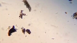 如何快速找到一只水熊虫，在显微镜下它又会是什么样子呢？