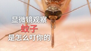 الملاحظة بالمجهر: كيف تلدغك البعوضة؟