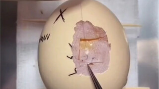 Dokter bedah menggunakan telur untuk mendemonstrasikan kecelakaan lalu lintas, pertolongan pertama, 