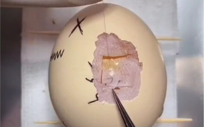 外科医生用鸡蛋演示车祸，急救，手术！