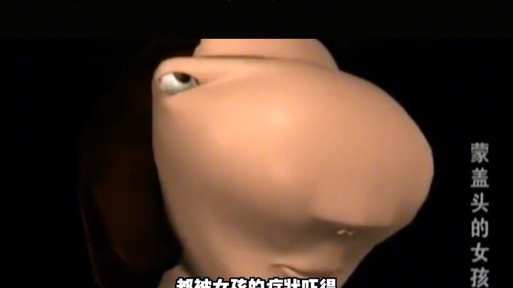 Guangzhou: “Horse-Faced Girl” Appears, Hid Her Face for 13 Years Out of Fear to Go Out; Doctor’s Exa