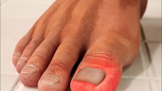 如果你把脚趾甲剪得太短，那么趾甲边缘就有可能往肉里长，长此以往容易引起甲沟炎