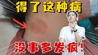 إذا أصبت بهذا المرض، ينصحك الطبيب بأن تُظهر علامات الجنون أكثر!