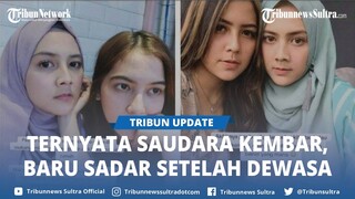 Viral, Kisah 2 Wanita Berwajah Mirip Dikira Sepupuan Ternyata Saudara Kembar, Baru Tahu Saat Dewasa
