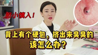 背上有个硬包，挤出来臭臭的，该怎么办？