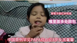 中国第一例世界罕见病女孩馨馨Papa综合征馨馨加油！