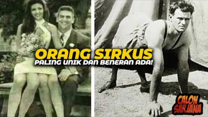 Beberapa Orang Sirkus dari Jaman Dahulu yang Beneran Ada dan Punya Keunikan Tergokil