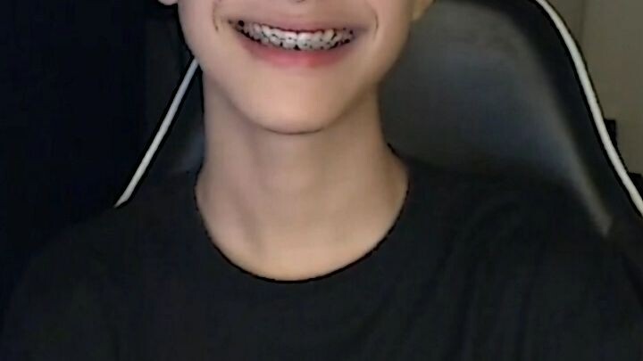 Marco's smile is very sweet😖