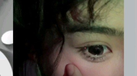 เมื่อแอนนี่ไม่เปิดฟิลเตอร์ความงาม