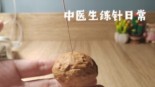 学会飞针就是看什么都想给它两针！