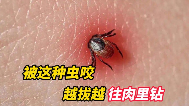 Đi chơi dịp 1/5 mà gặp phải loại bọ này, nhất định đừng nhổ! Càng nhổ nó càng bám chặt hút máu bạn đ