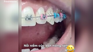 Nổi niềm của người niềng răng