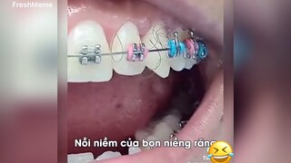 Nổi niềm của người niềng răng