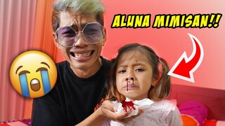 ALUNA M1MISAN KELUAR DAR4H DARI HIDUNGNYA‼️😭 SEDIH BANGET 😭😭