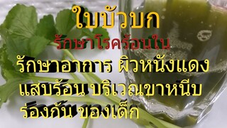 แชร์ประสบการณ์ ใบบัวบกรักษาร้อนใน/ รอยแดง แสบร้อนบริเวณร่องก้น ขาหนีบ /โดยฮอยไทยอีสาน