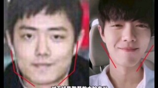 【肖战】割割整容热度不能降！