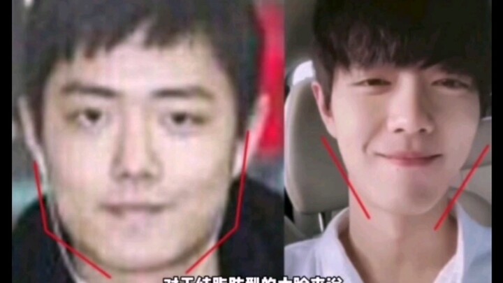 【肖战】割割整容热度不能降！