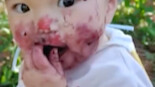 A 1-year-old baby ended up with a berry-stained face while clutching a bucket of mulberries.