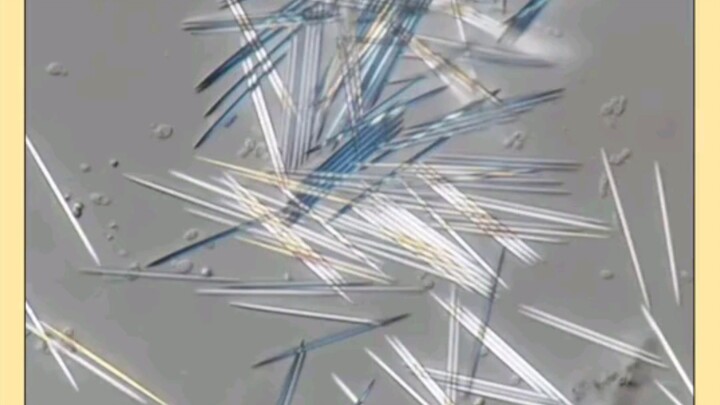 No wonder eating pineapple is so prickly (doge)