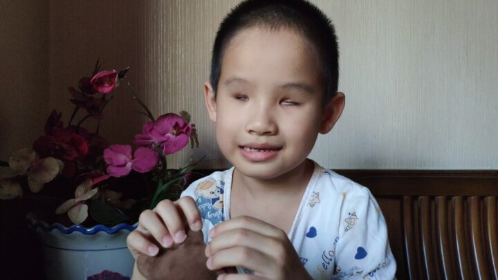 5岁没眼球自闭症儿子与我的日常