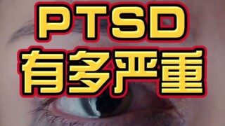 Seberapa parah sebenarnya PTSD itu? Lihat saja dia! Meski baru saja selamat dari petaka, dia malah m