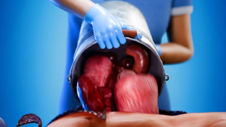 كيف تُجرى عملية التشريح؟