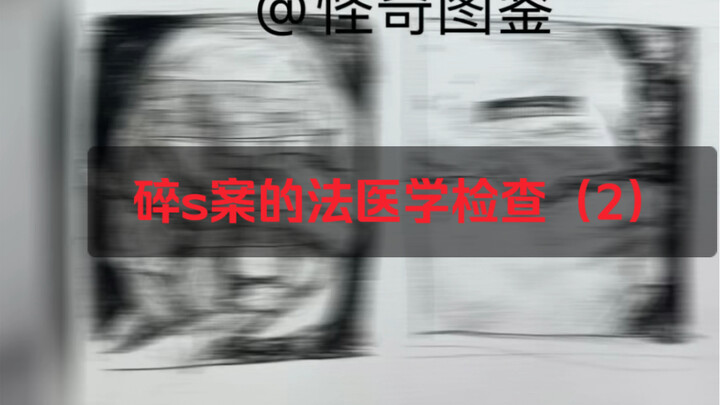 Kiểm tra pháp y các trường hợp vụn s, người yếu tim vui lòng cân nhắc!