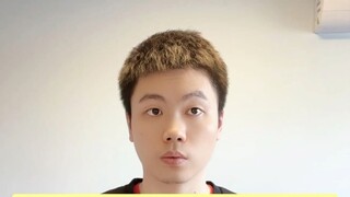Tác giả Akira Toriyama đã qua đời. Đây là mọi thứ bạn muốn biết về tụ máu dưới màng cứng!