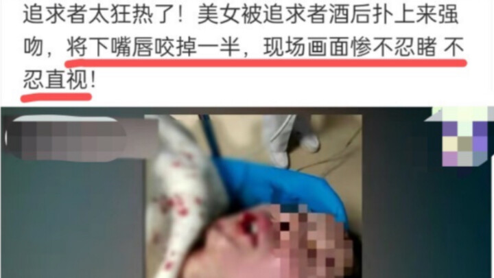 Kẻ theo đuổi quá cuồng loạn! Cắn đứt nửa môi dưới của cô gái, cảnh tượng thật kinh hoàng!