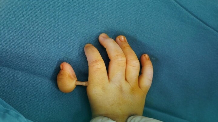 “The little meaty gourd” hangs from the palm, with thumb‑index‑finger opposition giving the child gr