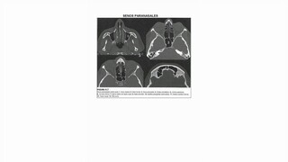 partes importantes de las glándulas superiores e inferiores