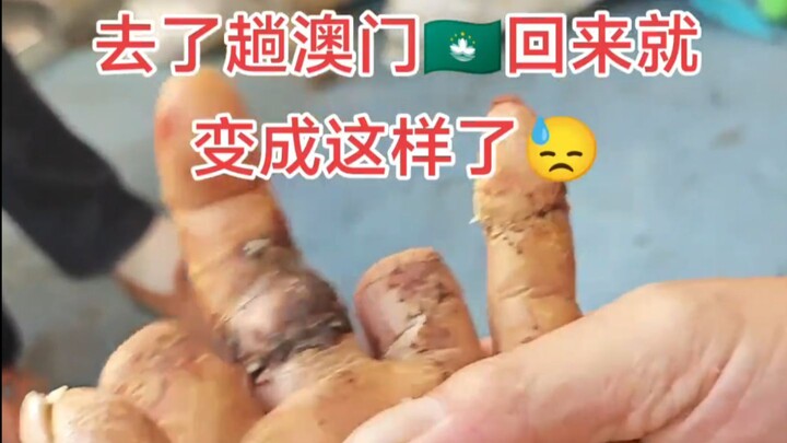 [DogBet TV] My hands turned into pig trotters after returning from Macau!