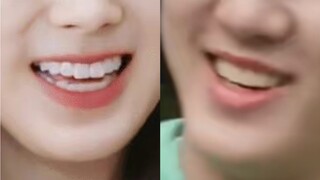 Hình như lại phát hiện thêm một cặp anh chị em cùng mẹ khác cha (bushi)